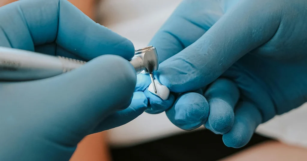 Zirconia crowns durability explained