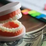 Hollywood smile procedure in Istanbul